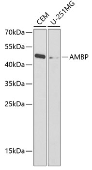AMBP Polyclonal Antibody (E-AB-67359)
