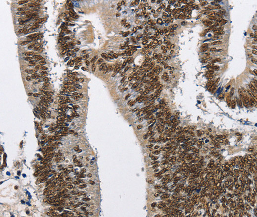 CMTM2 Polyclonal Antibody (E-AB-10237)