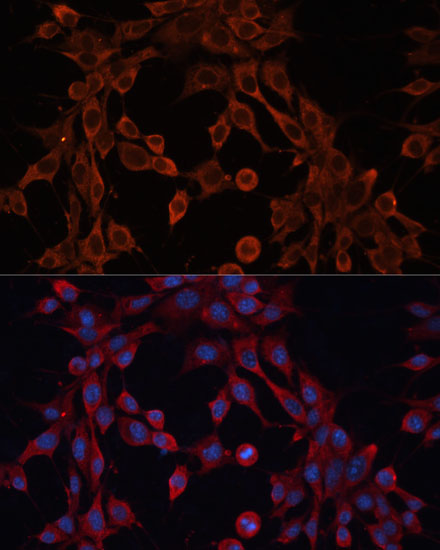 ABCA12 Polyclonal Antibody (E-AB-91865)