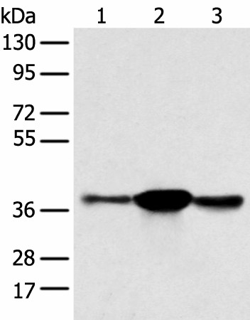 SPRY4 Polyclonal Antibody (E-AB-52220)