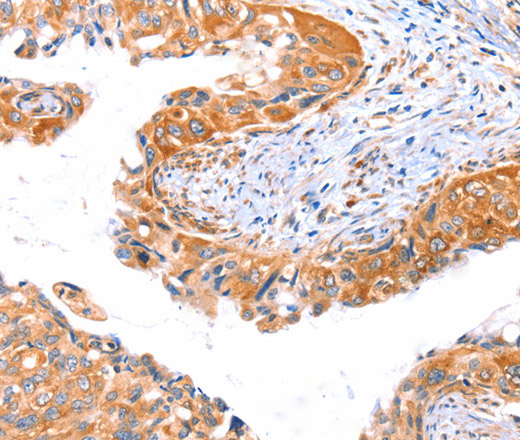 AP1B1 Polyclonal Antibody (E-AB-12971)