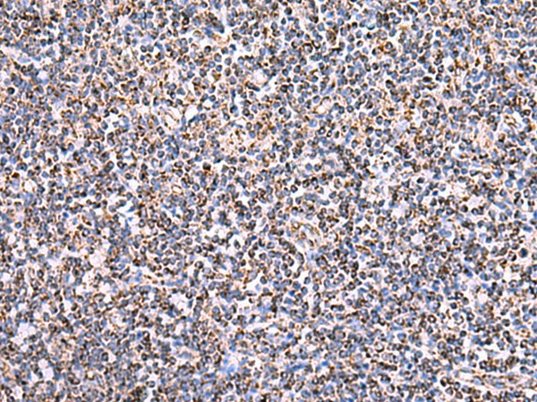 HSF2BP Polyclonal Antibody (E-AB-18069)