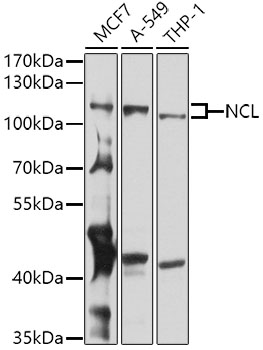 NCL Polyclonal Antibody (E-AB-68385)