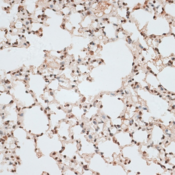 ZNF141 Polyclonal Antibody (E-AB-66353)