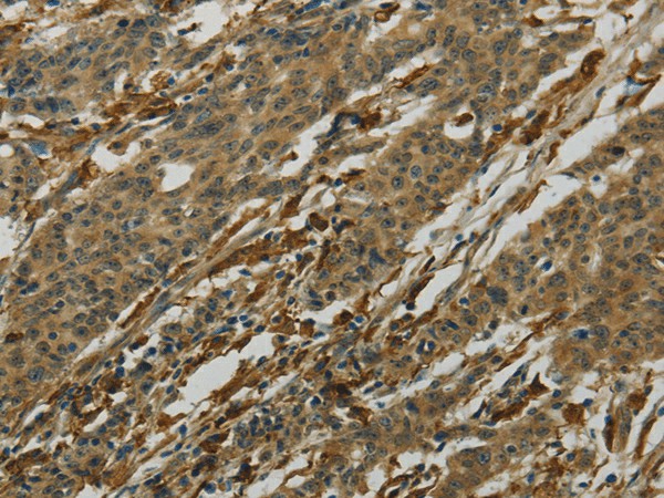 AIF1 Polyclonal Antibody (E-AB-16974)