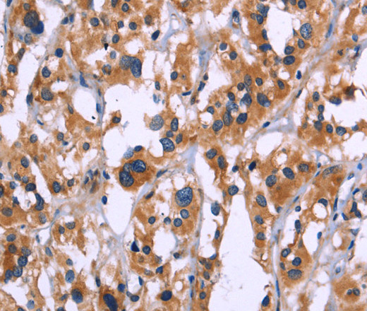 ZEB2 Polyclonal Antibody (E-AB-14342)