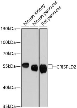 CRISPLD2 Polyclonal Antibody (E-AB-64496)