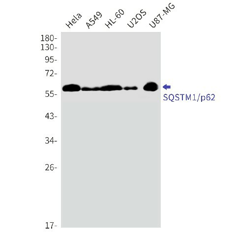 Recombinant SQSTM1/p62 Monoclonal Antibody (E-AB-81512)