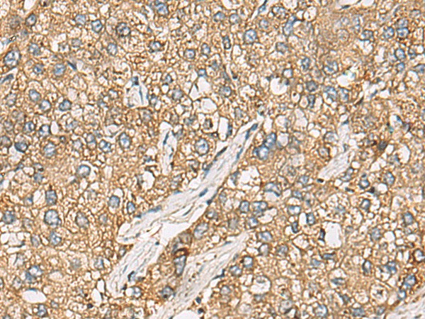 CHKA Polyclonal Antibody (E-AB-17799)