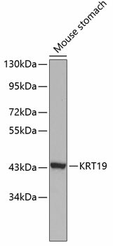 KRT19 Polyclonal Antibody (E-AB-60041)