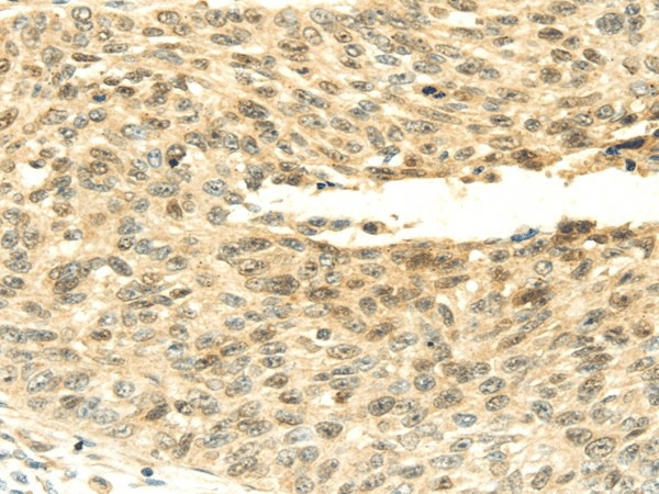 SHPRH Polyclonal Antibody (E-AB-17031)