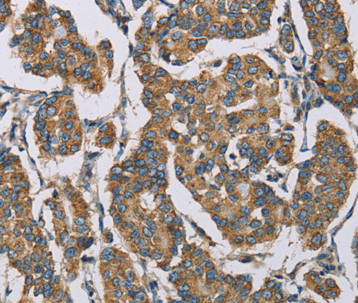 HDAC6 Polyclonal Antibody (E-AB-14126)