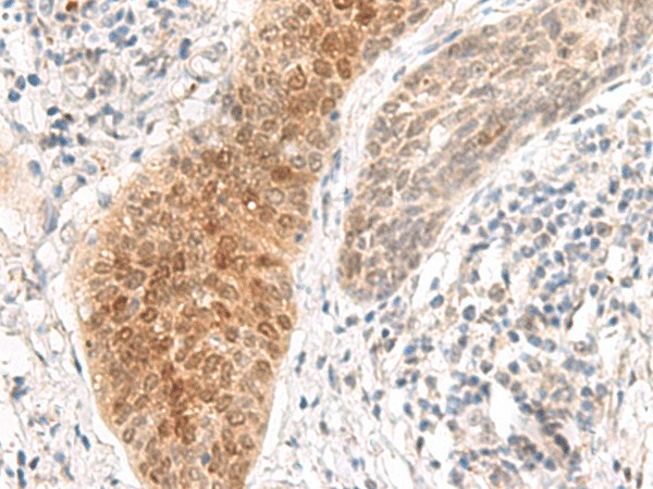 GHDC Polyclonal Antibody (E-AB-19908)