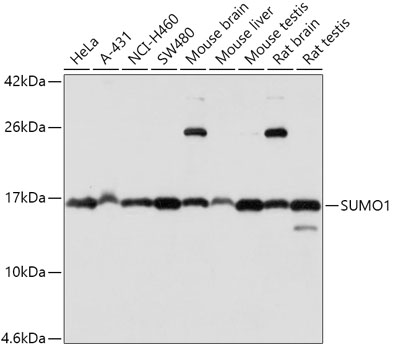 SUMO1 Polyclonal Antibody (E-AB-60626)