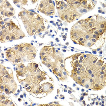 CHIT1 Polyclonal Antibody (E-AB-62673)