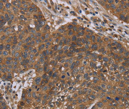OXTR Polyclonal Antibody (E-AB-13476)