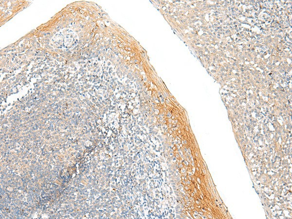 FAM110D Polyclonal Antibody (E-AB-18060)