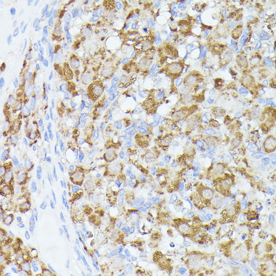 ACAT2 Polyclonal Antibody (E-AB-67921)