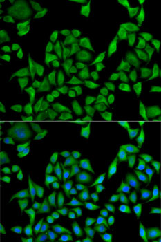 UGT1A1 Polyclonal Antibody (E-AB-67733)