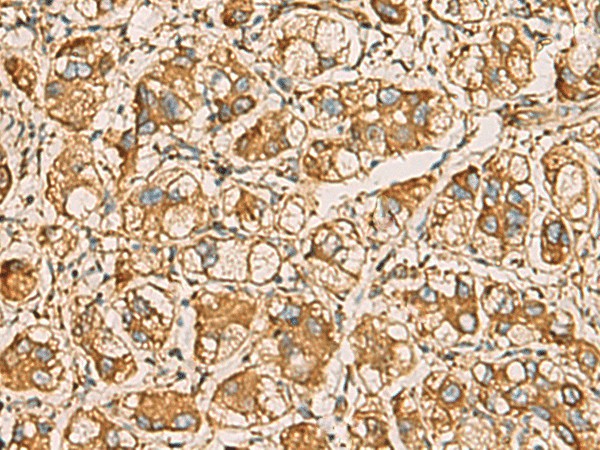 AIMP1 Polyclonal Antibody (E-AB-19224)