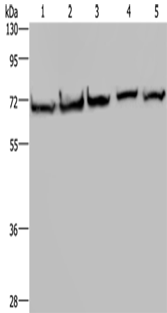 HSPA9 Polyclonal Antibody (E-AB-15085)