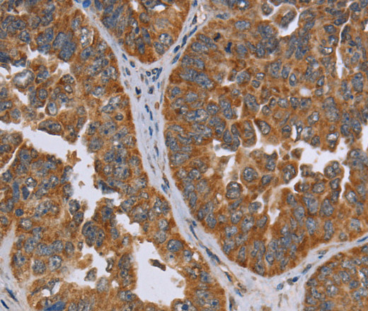 ADAMTS15 Polyclonal Antibody (E-AB-13935)