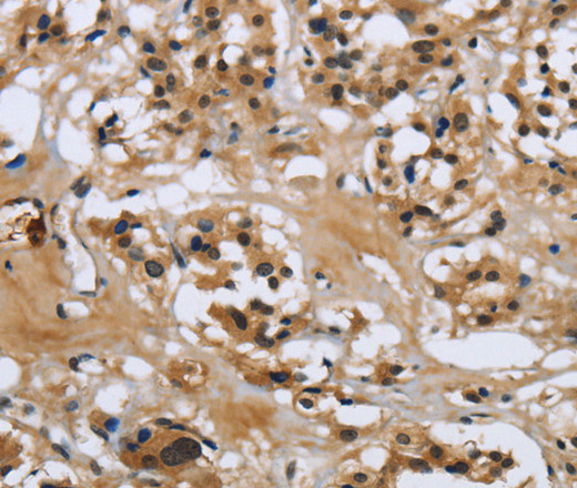 LGALS7 Polyclonal Antibody (E-AB-12442)