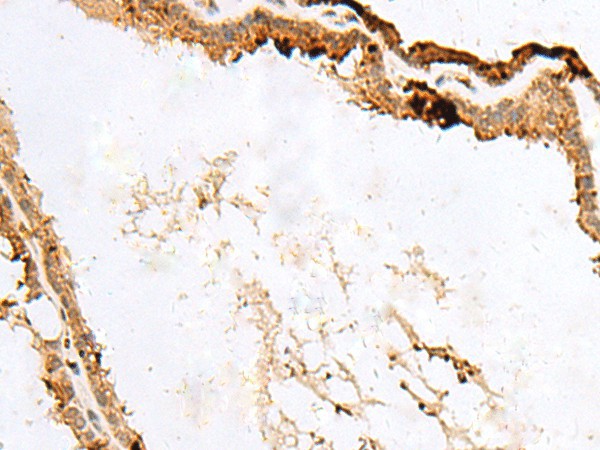 RABGGTA Polyclonal Antibody (E-AB-18849)
