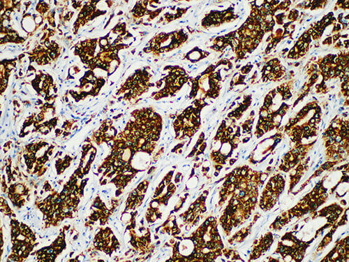 AMACR/p504s Monoclonal Antibody (ELAB6606-M)