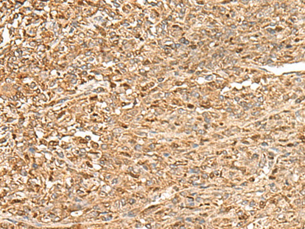ZC3H7A Polyclonal Antibody (E-AB-52701)