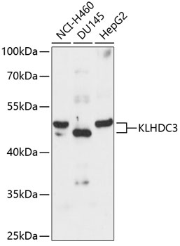 KLHDC3 Polyclonal Antibody (E-AB-90663)