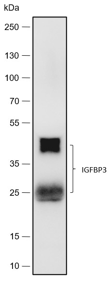 Recombinant IGFBP3 Monoclonal Antibody (AN301788L)