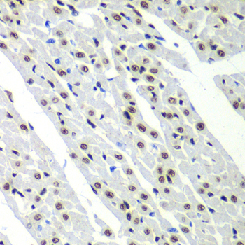 SF3B2 Polyclonal Antibody (E-AB-61816)