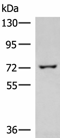 GLS Polyclonal Antibody (E-AB-19340)
