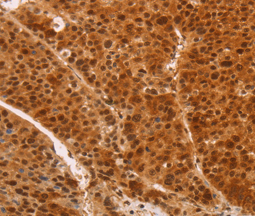 HEXIM1 Polyclonal Antibody (E-AB-14432)