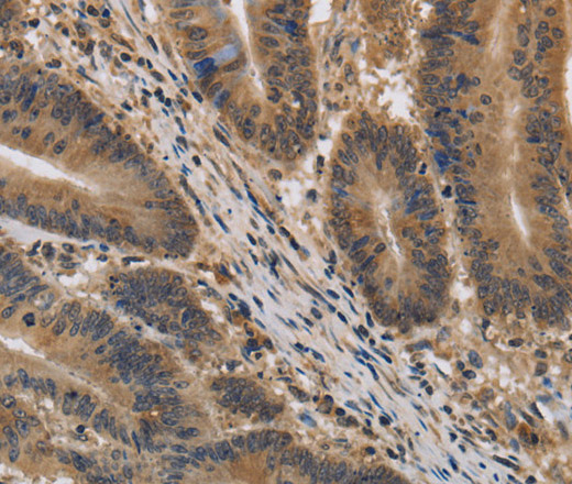 KIF22 Polyclonal Antibody (E-AB-13363)