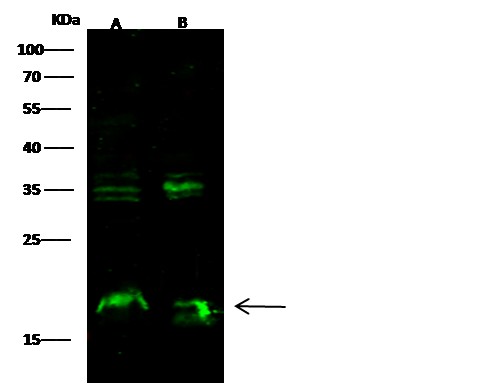 Recombinant Syndecan-4/SDC4 Monoclonal Antibody (AN300553P)