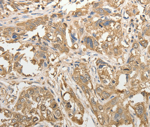 ADHFE1 Polyclonal Antibody (E-AB-12697)