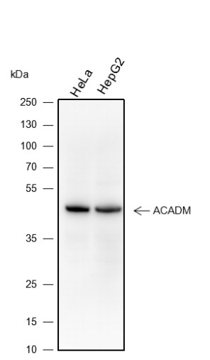Recombinant ACADM Monoclonal Antibody (AN301425L)