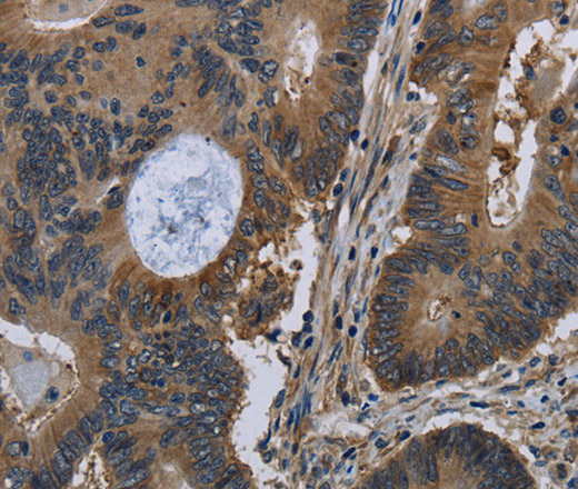 TSC22D3 Polyclonal Antibody (E-AB-15070)