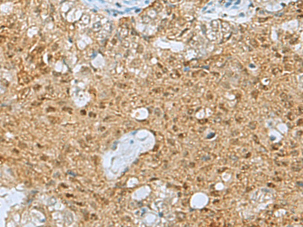 PTPA Polyclonal Antibody (E-AB-53148)