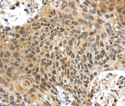 PLIN3 Polyclonal Antibody (E-AB-13506)