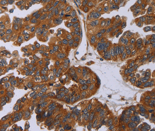 P2RY2 Polyclonal Antibody (E-AB-16673)