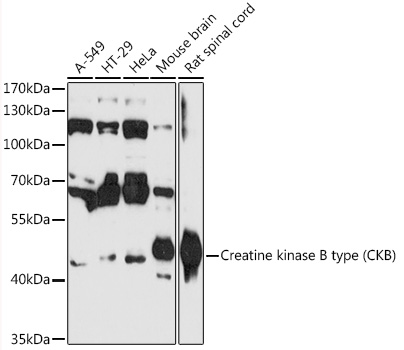 Creatine kinase B type Polyclonal Antibody (E-AB-90433)
