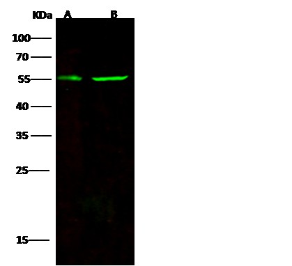 Recombinant CD83 Monoclonal Antibody (AN300013P)