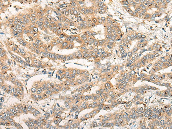 CPNE4 Polyclonal Antibody (E-AB-52558)