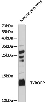 TYROBP Polyclonal Antibody (E-AB-90954)