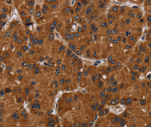 NPHS2 Polyclonal Antibody (E-AB-16657)