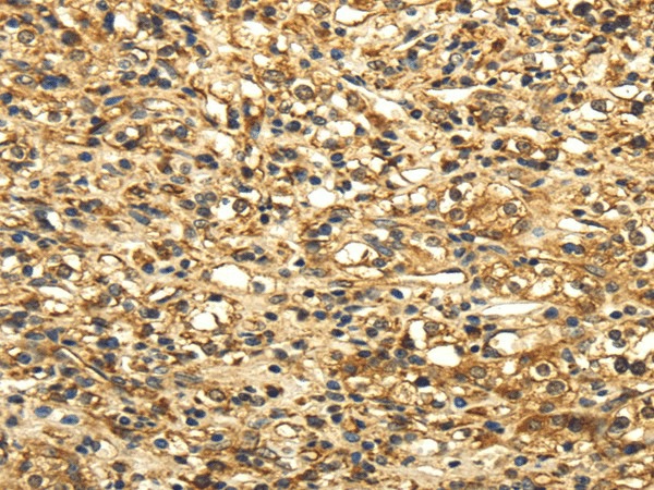 SLC6A19 Polyclonal Antibody (E-AB-17438)