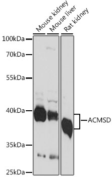 ACMSD Polyclonal Antibody (E-AB-91370)
